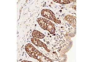 Immunohistochemistry (Paraffin-embedded Sections) (IHC (p)) image for anti-Ribosomal Protein L10 (RPL10) antibody (ABIN7075428)