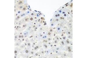 Immunohistochemistry of paraffin-embedded mouse liver using TARDBP antibody (ABIN6290985) at dilution of 1:100 (40x lens). (TARDBP Antikörper)