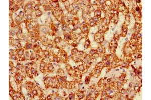 Immunohistochemistry of paraffin-embedded human liver tissue using ABIN7159651 at dilution of 1:100 (ALDH6A1 Antikörper  (AA 274-399))