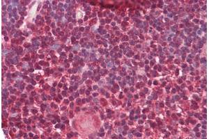 anti-Heterogeneous Nuclear Ribonucleoprotein K (HNRNPK) (AA 380-430) antibody