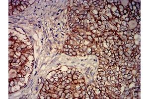Immunohistochemistry (IHC) image for anti-CD46 (CD46) (AA 35-179) antibody (ABIN7193208)