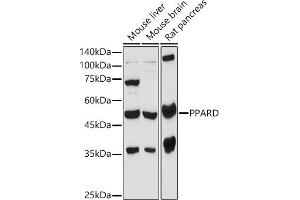 Western blot analysis of extracts of various cell lines, using PPARD antibody (ABIN6132423, ABIN6146002, ABIN6146003 and ABIN6221300) at 1:1000 dilution. (PPARD Antikörper  (AA 102-361))