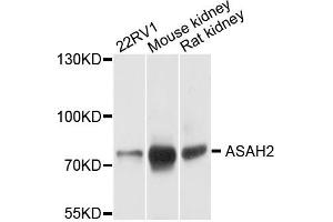Western blot analysis of extracts of mouse testis, using ASAH2 antibody. (ASAH2 Antikörper)