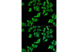 Immunofluorescence analysis of HeLa cell using AGA antibody.