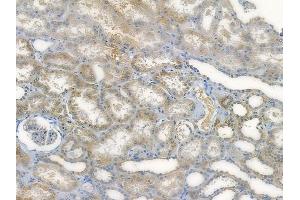 ABIN7096004 and ABIN7100066 at 1/100 staining human normal kidney tissue by IHC-P. (HERC3 Antikörper)