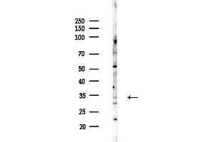 anti-Interleukin 20 Receptor beta (IL20RB) (Internal Region) antibody