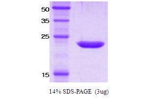 SDS-PAGE (SDS) image for Killer Cell Immunoglobulin-Like Receptor, Two Domains, Short Cytoplasmic Tail, 4 (KIR2DS4) protein (ABIN666835) (KIR2DS4 Protein)