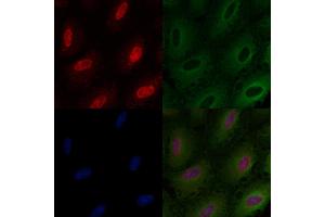ABIN6260045 and ABIN6276424 staining  cells by IF/ICC. (ARNT Antikörper  (N-Term))