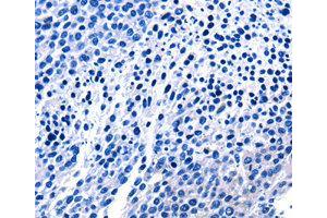 Immunohistochemistry (IHC) image for anti-Epidermal Growth Factor (EGF) antibody (ABIN1872450) (EGF Antikörper)