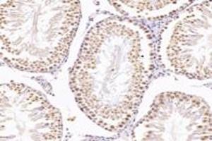 Immunohistochemistry analysis of paraffin-embedded mouse testis using,NUDT22 (ABIN7074928) at dilution of 1: 7200 (NUDT22 Antikörper)
