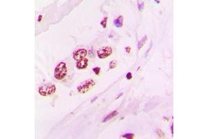 Immunohistochemistry (IHC) image for anti-Nuclear Receptor Subfamily 2, Group F, Member 6 (NR2F6) (N-Term) antibody (ABIN7295606)