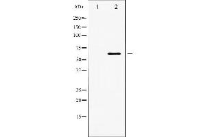 Western blot analysis of PDK1 expression in EGF treated MDA-MB-435 whole cell lysates,The lane on the left is treated with the antigen-specific peptide. (PDPK1 Antikörper  (Internal Region))