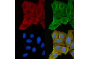 ABIN6256606 and ABIN6268850 staining Hela cells(30 min of UV treatment) by IF/ICC. (DCT Antikörper  (N-Term))