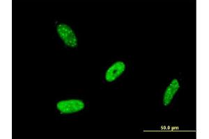 Immunofluorescence of monoclonal antibody to RBMS2 on HeLa cell. (RBMS2 Antikörper  (AA 308-407))
