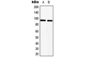 Western blot analysis of TLE2 expression in HeLa (A), Jurkat (B) whole cell lysates. (TLE2 Antikörper  (Center))