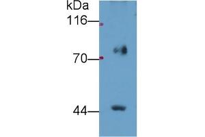 Detection of FADS2 in Porcine Lung lysate using Polyclonal Antibody to Fatty Acid Desaturase 2 (FADS2) (FADS2 Antikörper  (AA 1-130))