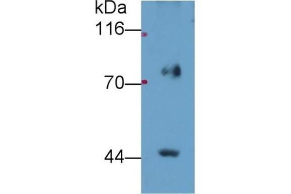 FADS2 Antikörper  (AA 1-130)