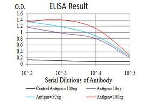 Black line: Control Antigen (100 ng), Purple line: Antigen(10 ng), Blue line: Antigen (50 ng), Red line: Antigen (100 ng), (Histone Cluster 2, H3c (HIST2H3C) (acLys27) Antikörper)