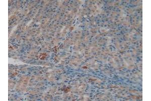 Immunohistochemistry (IHC) image for anti-Coagulation Factor II (thrombin) (F2) (AA 324-617) antibody (ABIN7440125)