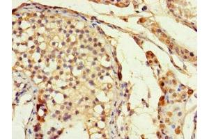Immunohistochemistry of paraffin-embedded human testis tissue using ABIN7155679 at dilution of 1:100 (DLX5 Antikörper  (AA 1-249))