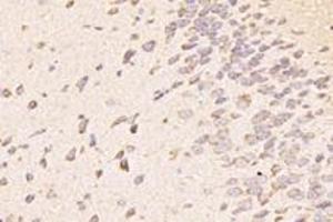 Immunohistochemistry analysis of paraffin-embedded mouse striatum using,TTL (ABIN7076048) at dilution of 1: 4000
