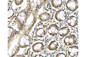 IHC analysis of ITCH/AIP4 using anti-ITCH/AIP4 antibody (ABIN7600264). (ITCH Antikörper  (AA 17-358))