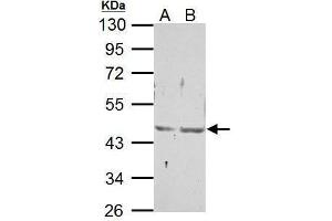WB Image Sample (30 ug of whole cell lysate) A: NIH-3T3 B: JC 10% SDS PAGE antibody diluted at 1:500 (NR2F6 Antikörper  (C-Term))