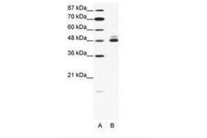 Image no. 1 for anti-Cholinergic Receptor, Nicotinic, beta 2 (Neuronal) (CHRNB2) (AA 21-70) antibody (ABIN202670) (CHRNB2 Antikörper  (AA 21-70))