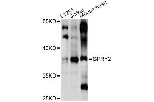 Western blot analysis of extracts of various cell lines, using SPRY2 antibody (ABIN6293587) at 1:1000 dilution. (SPRY2 Antikörper)