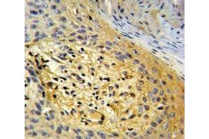 Immunohistochemistry (IHC) image for anti-Secreted Protein, Acidic, Cysteine-Rich (Osteonectin) (SPARC) (AA 224-251) antibody (ABIN3032525)