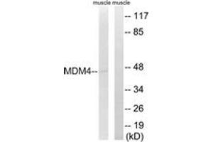 Western blot analysis of extracts from rat muscle cells, using MDM4 (Ab-367) Antibody. (MDM4-binding Protein Antikörper  (AA 336-385))