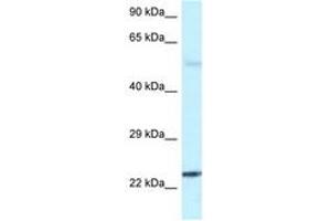 Image no. 1 for anti-RAB31, Member RAS Oncogene Family (RAB31) (C-Term) antibody (ABIN6747504) (RAB31 Antikörper  (C-Term))