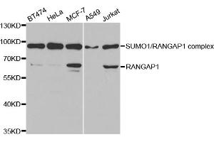 Western blot analysis of extracts of various cell lines, using RANGAP1 antibody. (RANGAP1 Antikörper)
