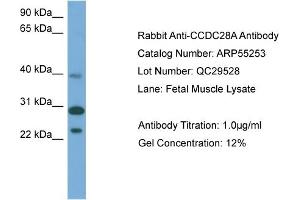 WB Suggested Anti-CCDC28A  Antibody Titration: 0. (CCDC28A Antikörper  (Middle Region))
