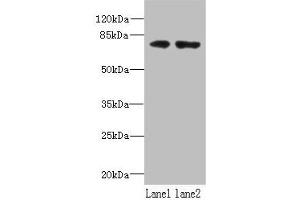 Western blot All lanes: WDTC1 antibody at 1. (WDTC1 Antikörper  (AA 201-420))