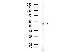 anti-Glucosaminyl (N-Acetyl) Transferase 6 (GCNT6) (N-Term) antibody