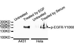 Western blot analysis of extracts of various cell lines, using Phospho-EGFR-Y1068 antibody. (EGFR Antikörper  (pTyr1092))
