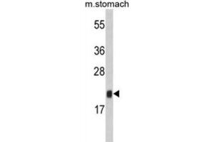 Western Blotting (WB) image for anti-FK506 Binding Protein 11, 19 KDa (FKBP11) antibody (ABIN3002801) (FKBP11 Antikörper)