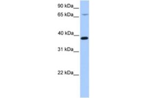 Western Blotting (WB) image for anti-Hydroxymethylbilane Synthase (HMBS) antibody (ABIN2463631) (HMBS Antikörper)