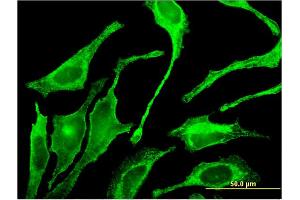 Immunofluorescence of monoclonal antibody to GALNT1 on HeLa cell.