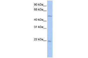 WB Suggested Anti-SDCBP2 Antibody Titration: 0. (SDCBP2 Antikörper  (N-Term))