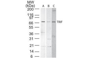 TRIF Western Blot. (TICAM1 Antikörper)