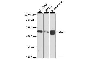 Western blot analysis of extracts of various cell lines using LKB1 Polyclonal Antibody at dilution of 1:1000. (LKB1 Antikörper)