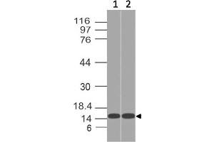 Image no. 1 for anti-Acyl-CoA Thioesterase 13 (ACOT13) antibody (ABIN5027794)
