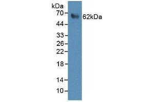 WB analysis of recombinant Human PRF1 Protein, using Rabbit anti-Human PRF1 antibody (abx100625). (Perforin 1 Protein)