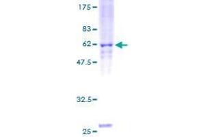 Image no. 1 for RASD Family, Member 2 (RASD2) (AA 1-266) protein (GST tag) (ABIN1317482) (RASD2 Protein (AA 1-266) (GST tag))