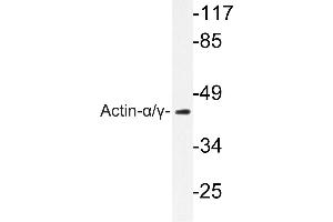 Image no. 2 for anti-Actin (pan) antibody (ABIN271986) (Actin Antikörper  (pan))