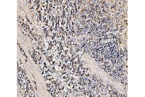 IHC analysis of HMGCS2 using anti-HMGCS2 antibody (ABIN7599435).