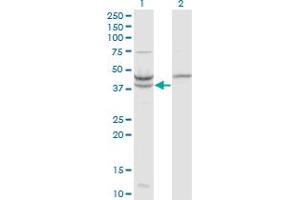 Western Blotting (WB) image for anti-Ureidopropionase, beta (UPB1) (AA 285-384) antibody (ABIN526897)