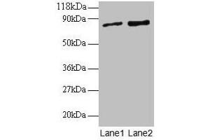 Western blot All lanes: RAB1A antibody at 2 μg/mL Lane 1: EC109 whole cell lysate Lane 2: 293T whole cell lysate Secondary Goat polyclonal to rabbit IgG at 1/15000 dilution Predicted band size: 23, 16, 14 kDa Observed band size: 80 kDa (RAB1A Antikörper  (AA 2-205))